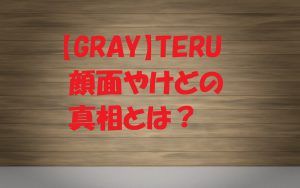 TERU顔面やけどの理由と真相とは？いつライブ復帰できる？後遺症はある？
